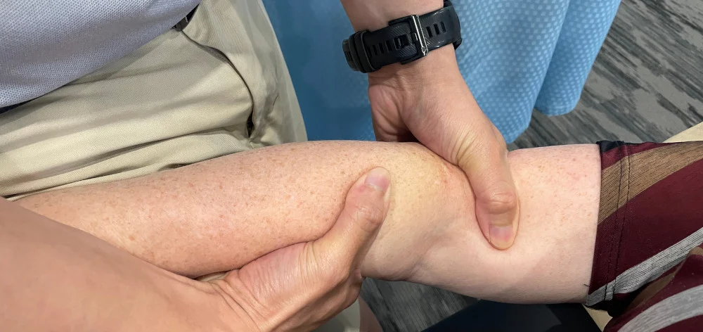 elbow treatment 2