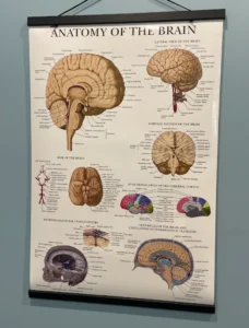 concussion treatment at Sheddon Physiotherapy Clinic Burlington