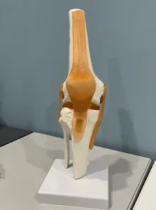 jumpers knee