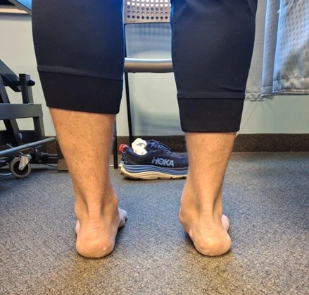 Common Causes of Shin Splints Sports Injury Rehabilitation Burlington
