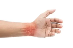 De Quervain wrist pain from phone use in Burlington