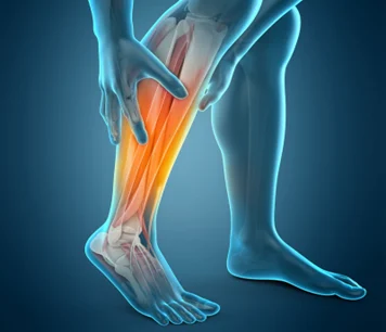 The Surprising Link Between Tight Calves and Foot Pain