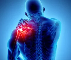 Shoulder joint pain and inflammation caused by side sleeping explained by Burlington physiotherapy clinic