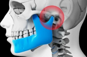 TMJ joint anatomy and jaw movement explained by Burlington physiotherapy specialists